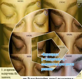 Карепрост для ресниц отзывы